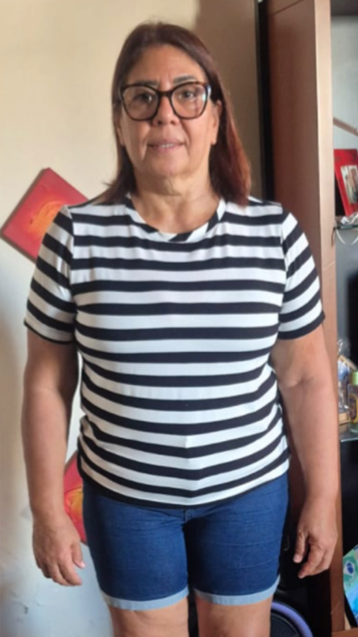 Antes e Depois 10