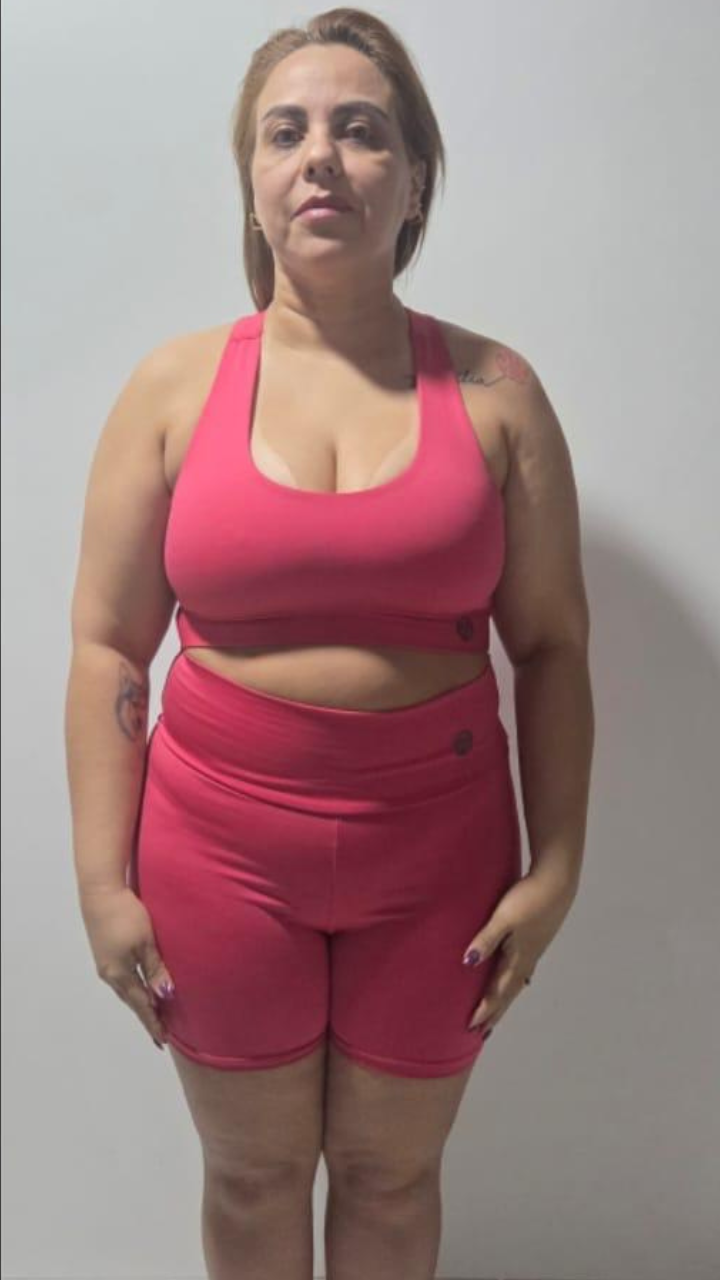Antes e Depois 7