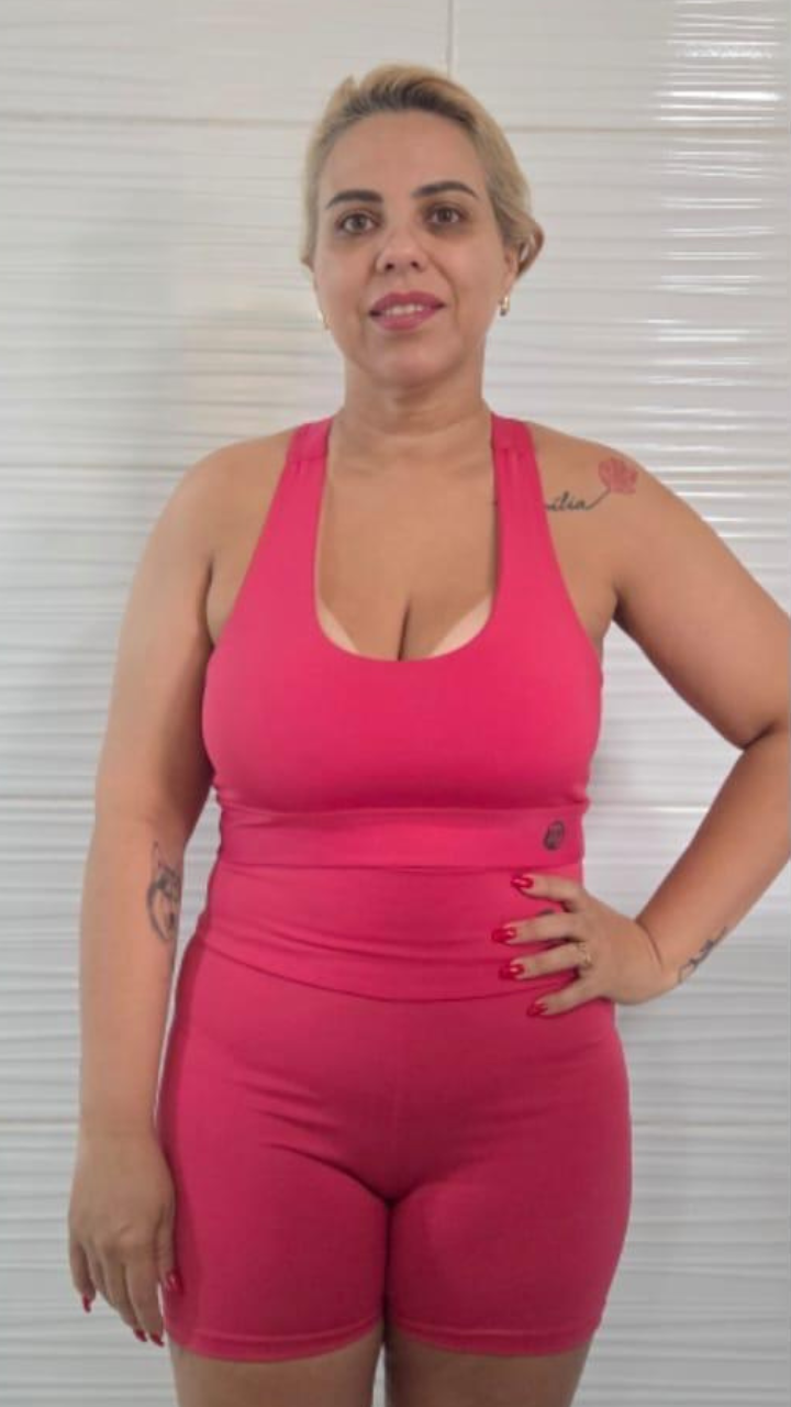 Antes e Depois 8
