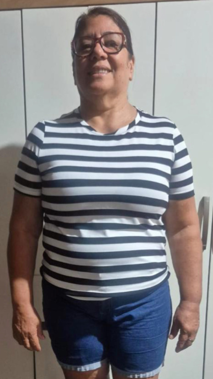Antes e Depois 9